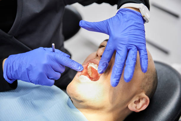 Best Emergency Root Canal Treatment in Gary, IN